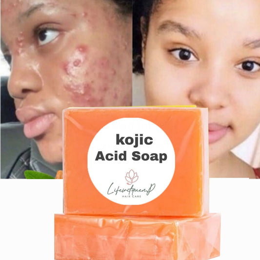 Kojie Acid Soap